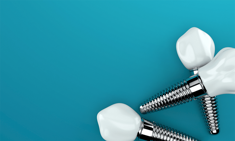 Cost of Dental Implant in Houston