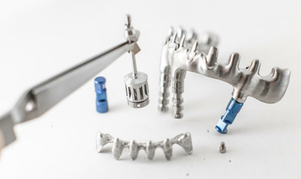 What Is A Subperiosteal Implant? | Voss Dental Houston, TX